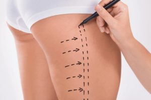 Uyluk (Üst Bacak) Germe Nasıl Yapılır?