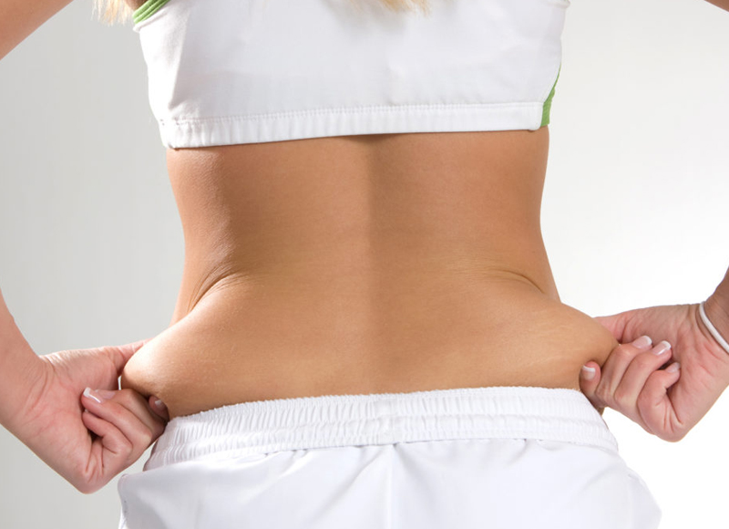 liposuction-nasil-yapilir